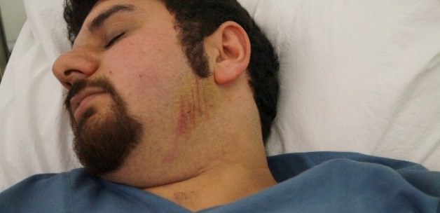 iki_kardesin_darp_ettigi_doktor_yogun_bakimda_1421848177_8167
